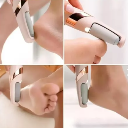 RenovaFeet™ – Elimina asperezas y callos de tus pies.